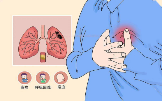 醫生提醒：如果出現下圖當中的「三聯征」時，一定要及時就醫，情況嚴重時，要儘快撥打120急救電話。