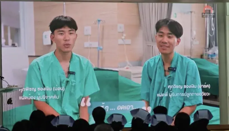 泰國清邁大學醫學院完成一場意義非凡的同卵雙胞胎活體肝移植手術，Suphawit Songngern靠雙胞胎兄弟Supphich Songngern捐贈的65%肝臟重獲新生。（來源：Chiang Mai Citylife）