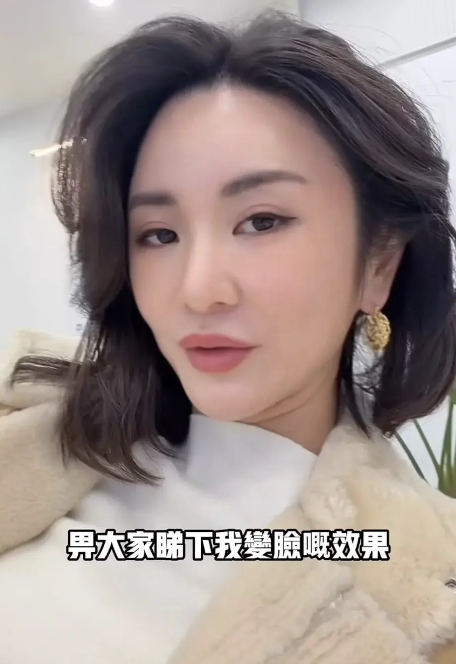 事實上，裕美早因鼻樑越來越直遭整容猜測，過去她曾以「瘦咗」「沒 Baby fat」回應，林作更曾替她解釋是「形象轉變 + 混血樣貌」，甚至提出邀整容醫生作證，如今二人一認一鬧，再度引爆話題。(圖：wadahiromi@IG)