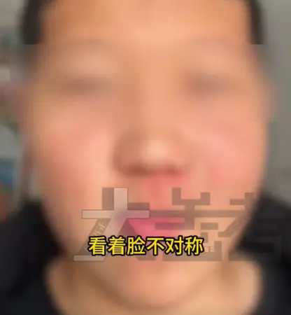 河南鄭州一名15歲少年小澤，一段時間以來左臉莫名腫了起來，媽媽起初沒太在意，只當是孩子最近飲食不節制、長胖了，甚至還打趣孩子是不是偷偷吃了太多零食。（來源：內地媒體《大參考》）