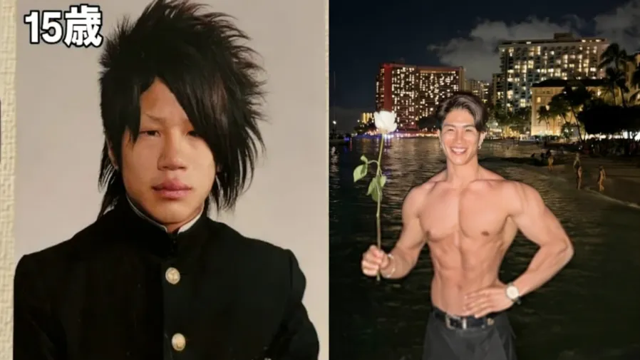 日本33歲小哥慘被罵「豬狒狒」，怒砸百萬円整容操肌，變臉後認不出！的封面圖片