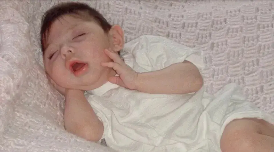 亞歷克斯出生時，父母羅蕾娜（Lorena）與肖恩（Sean）還沈浸在喜悅中，以為女兒和其他健康寶寶一樣。 直到兩個月後的檢查，一記晴天霹靂打破了平靜——亞歷克斯患上了腦積水性無腦畸形（Hydrocephalic Anencephaly）。（來源：網絡）