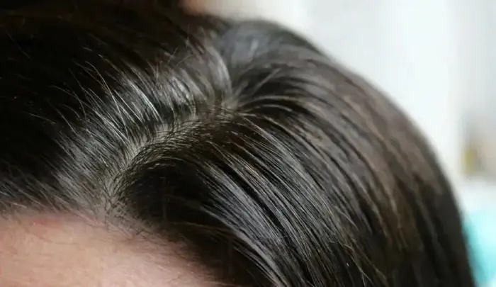 鏡子裡突然竄出的幾根白髮，總是讓人瞬間慌張——明明還沒到該長白髮的年紀，怎麼就提前「報到」了？（示意圖來源：images）