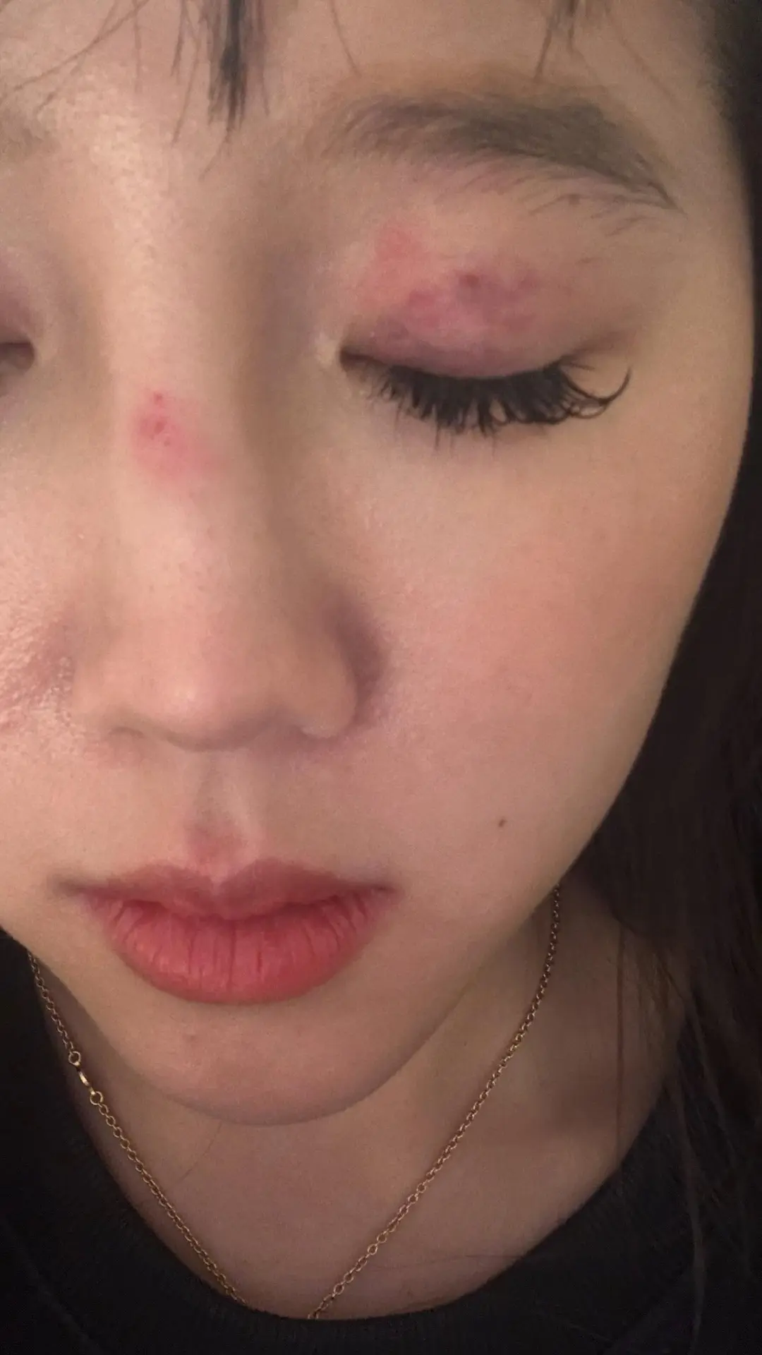 Vanessa為了避免衝突選擇道歉，卻不料遭到四名少女的拳打腳踢，造成多處受傷。(圖：vanessa._.42@threads)