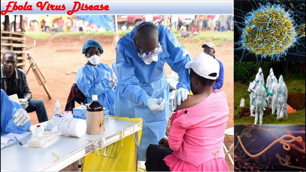 聯合國人道事務協調廳（OCHA）警示，剛果民主共和國（DRC）爆發的邦迪布焦伊波拉疫情急速惡化，每30分鐘就有一人病逝，確診與死亡人數持續攀升，病毒已出現跨境傳播風險，醫療資源與人力缺口嚴重。（來源：BARUN DUTTA@YouTube）
