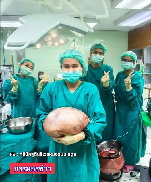 泰國沙敦府女子拉差娜蓬因長期腹脹被誤認為發福，實為 8 公斤巨大卵巢囊腫。（來源：คลินิกสูตินรีเวชหมอธมน สตูล@FB）