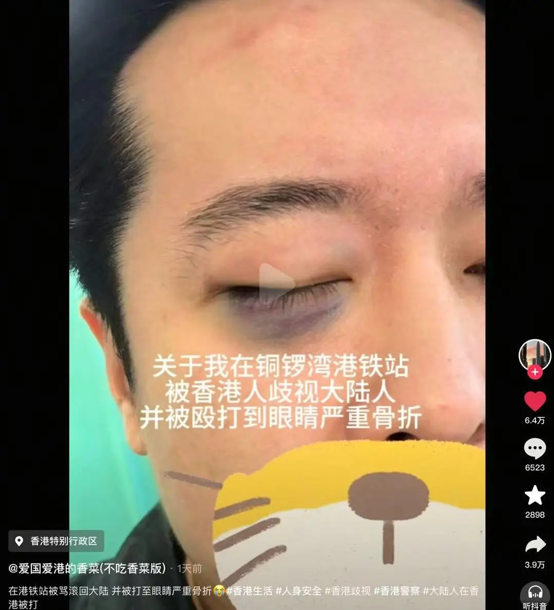 事主與朋友在銅鑼灣站下車時，因朋友的雨傘意外觸碰到一名本地男子。這名男子隨即與其女伴對他們出言侮辱。(圖：抖音翻攝)