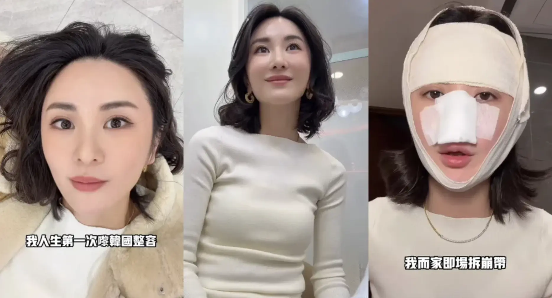 10 月尾，裕美在社交平台上載名為「我的整容歷程 in 🇰🇷」的短片，開頭就霸氣直言：「我人生第一次嚟韓國整容，俾大家睇下我變臉嘅效果，今次你哋可以話我整容喇！」(圖：wadahiromi@IG)