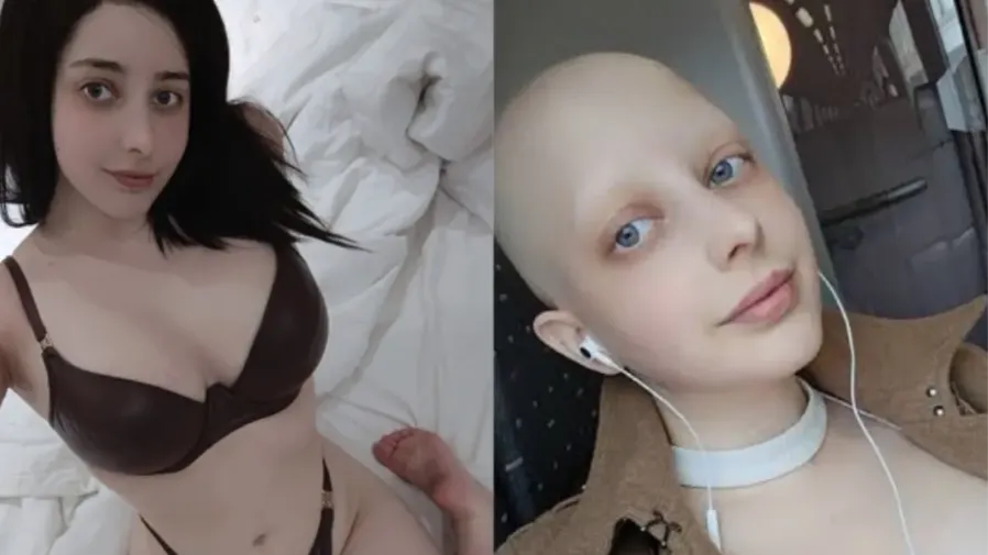 拍片竟能救命？OnlyFans女模意外發現乳癌，獨特抗癌方式超圈粉的封面圖片