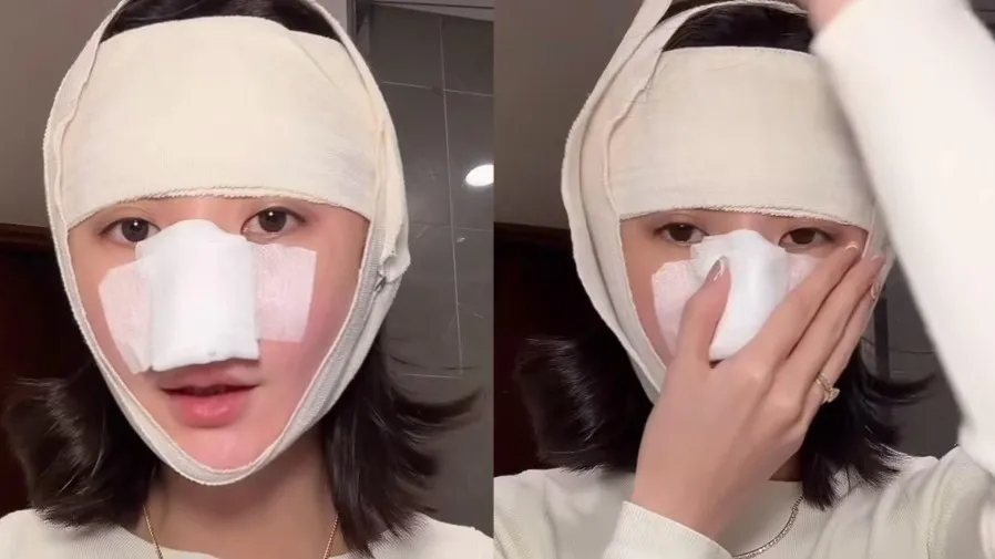 裕美首認韓國整容!注射膠原針改善臉頰凹陷,術後 3 日腫臉似倉鼠,林作搞笑鬧分手的封面圖片