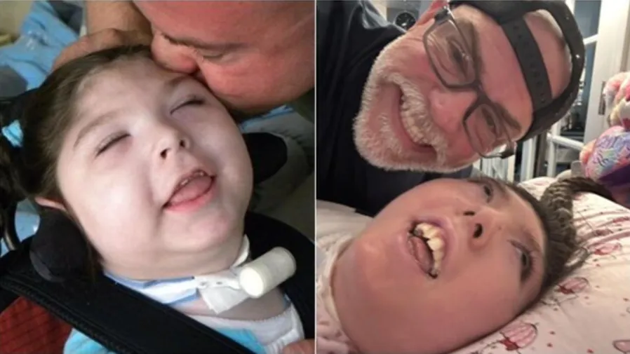 天生「無腦」被判定活不到5歲，美國女子竟歡度20歲生日的封面圖片