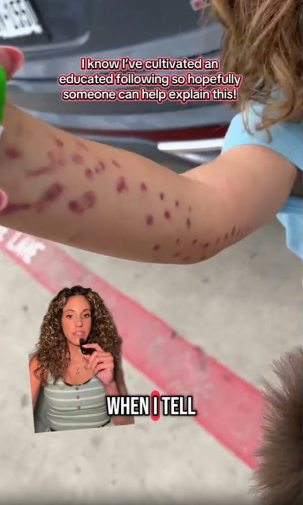 美國德州 San Antonio Aquarium 水族館內，6 歲男童（Leo）伸手與北太平洋巨型章魚互動時遭其攻擊，章魚緊吸男童手臂不放，3 名工作人員才將其拉開。（來源：Britneytaryn@TikTok）