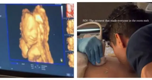加拿大一對準爸媽做3D超音波產檢，爸爸親吻孕肚向胎兒女兒問好，寶寶竟疑似揚起嘴角微笑。畫面拍下後網路瘋傳破5000萬觀看，滿滿溫暖打動全球無數網友。（來源：liaolive_@IG）