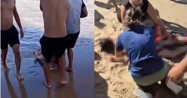 巴西伯南布科州連發鯊魚襲人慘案，19歲少女利馬桑托斯於海灘戲水遭虎鯊咬斷右腿，經急救撿回性命。（來源：X）