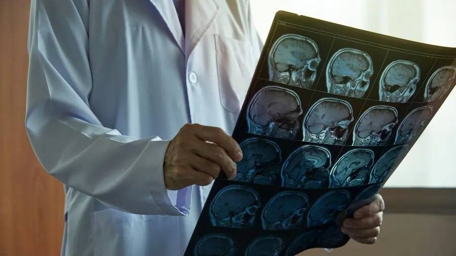 若需要更深入評估，醫師可能安排腦部 MRI 或 CT，以確認是否有中風、腫瘤或其他腦部疾病。