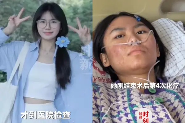 內地雲南女孩李雅平考研上岸後，確診大腸癌晚期，她坦言長期便血曾誤認為是痔瘡。其母此前也確診乳腺癌晚期，母女共抗病魔，她靠直播帶貨籌措醫療費，以樂觀對抗磨難。（來源：封面新聞）