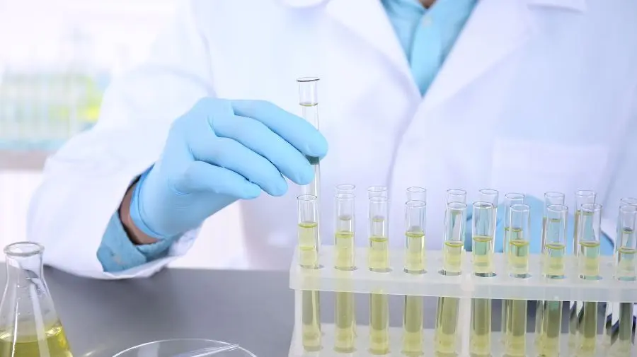 尿液的顏色判斷也是重要的一環