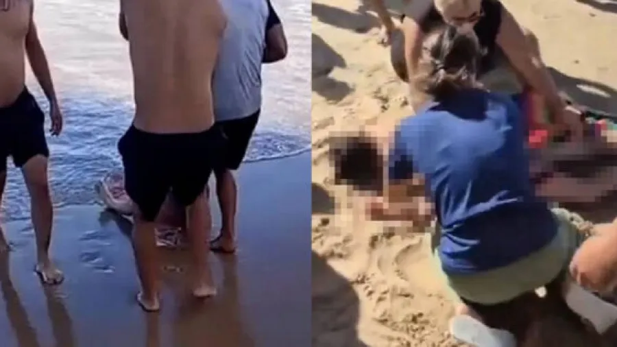 巴西海灘驚現鯊魚襲擊！19歲少女遊泳遇襲右腿慘遭咬斷的封面圖片
