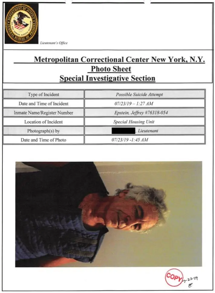 愛潑斯坦在獄中意圖自殺後的照片。（圖/US Department of Justice ）
