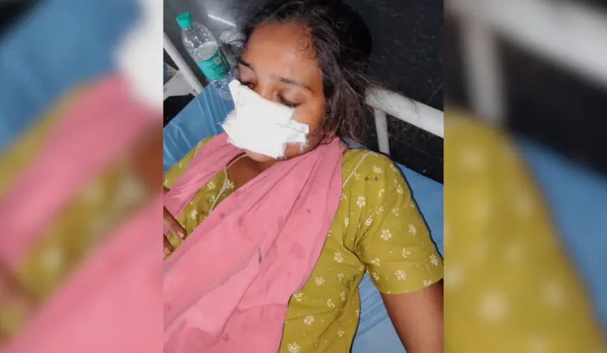 印度泰倫加納邦（Telangana）一名男子因不滿妻子分居不願返家，氣憤闖入娘家施暴，持棍重傷岳父，更失控咬掉妻子大片鼻子，導致妻子嚴重毀容，警方已立案調查。（來源：新德里電視台）