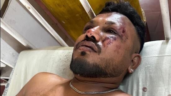 唯一生還者 Vishwash（Aman Sharma＠x.com）