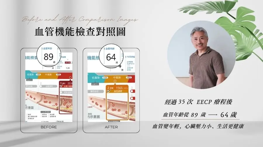 經過 35 次療程後，頸動脈血流改善，血壓也下降，證明血管彈性獲得明顯提升