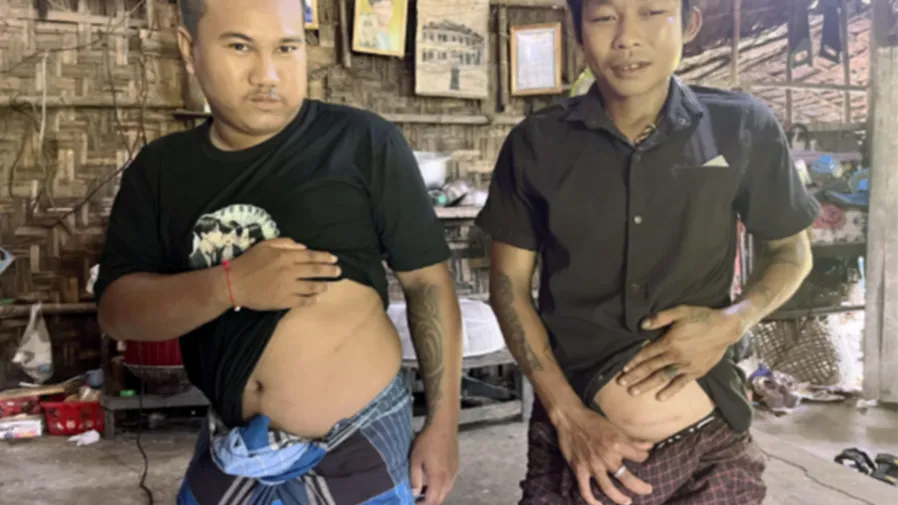 一顆腎700萬緬幣!緬甸村落半數人出賣器官,跨國黑鏈吞噬無數家庭的封面圖片