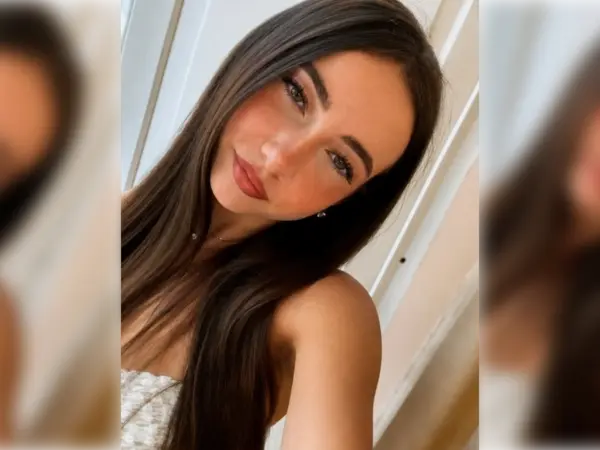 馬爾他18歲舞者凱莉（Kelly Caruana）搭乘車輛時，因撿拾掉落手機遇車禍，遭彈開的安全氣囊重擊臉部，經9天搶救無效離世，家屬控氣囊為致命主因，案件仍在調查中。（來源：FB）