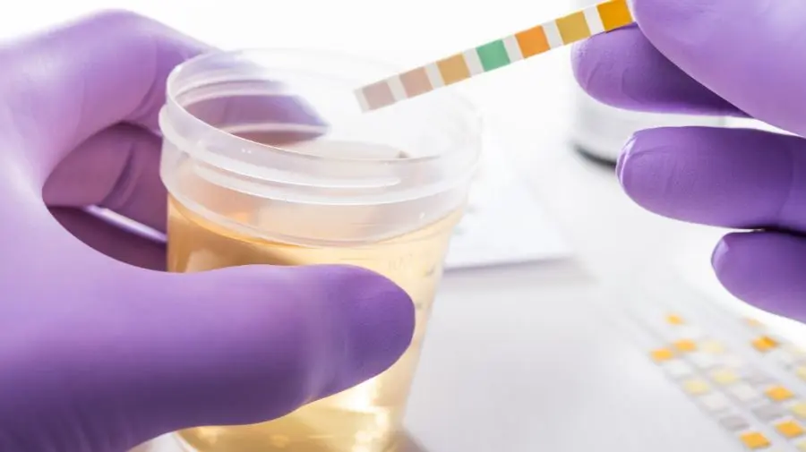 當肝膽代謝出問題時，尿液顏色會變成最忠實的提示卡。