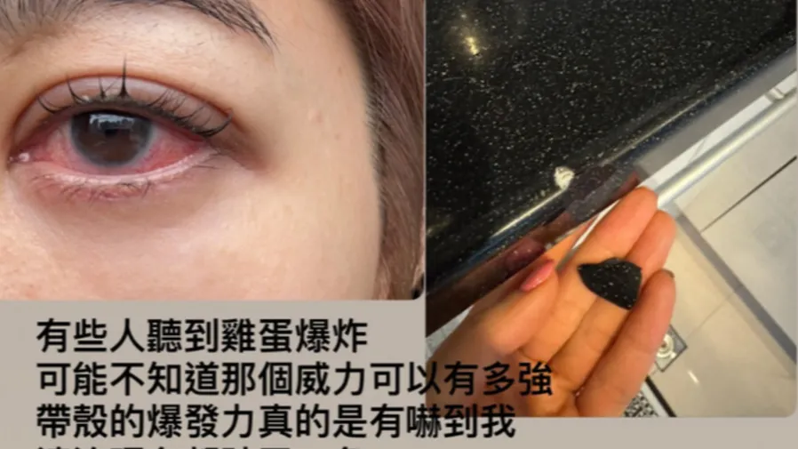 「八點檔林志玲」王晴微波爐煮蛋引爆炸,眼睛慘遭重創!的封面圖片