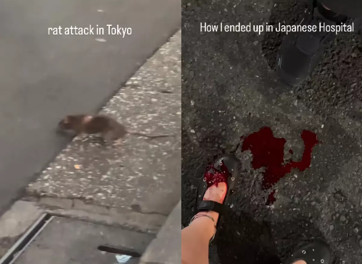 杜拜的女遊客 Tutku 本月 9 日透過 Instagram 分享驚悚遭遇，她在新宿走出酒店不久，腳部突然被老鼠咬傷，鮮血直流到路面。​（圖：yogitutty@IG）